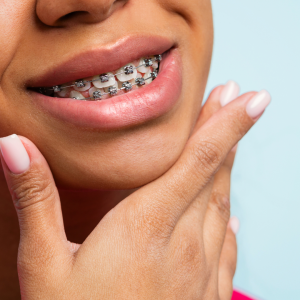 Braces