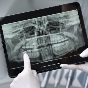 Exams and X-Rays