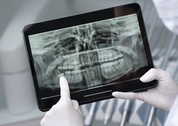 Exams and X-Rays