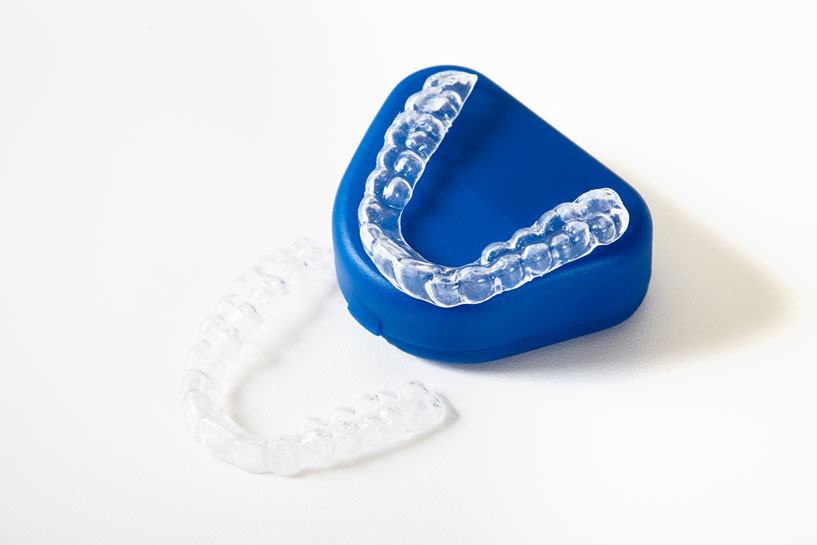 Protecting Your Smile: The Essential Role of Custom Mouthguards for Sports in Kenya 1 Mouthguard-SmileArt-Kenya-